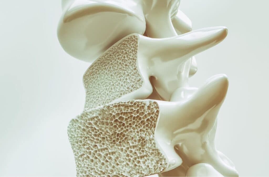 Fakty i mity o osteoporozie